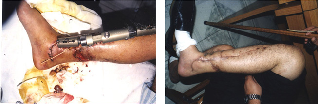 首页|bwin必赢亚洲集团中国官方网站