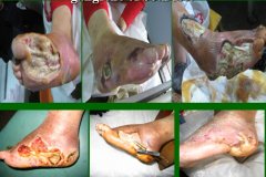 1-141120224253430-lp